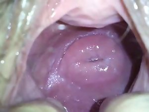 my sensual japanese girlfend&#039;s sensual cervix in huge hole